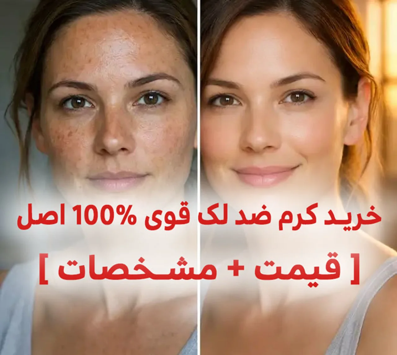 خرید کرم ضد لک قوی 100% اصل کاملا درمانی [ قیمت + مشخصات ]