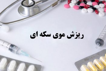 درمان ریزش موی سکه ای