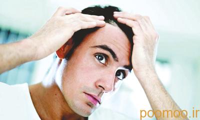 درمان ریزش مو,جلوگیری از ریزش مو,ریزش مو