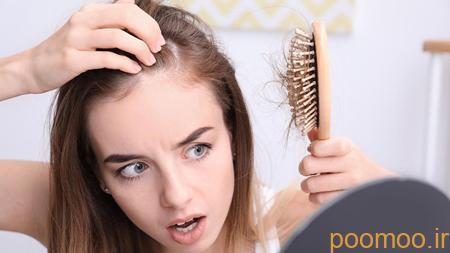 برای جلوگیری از ریزش مو, جلوگیری ریزش مو, برای جلوگیری از ریزش مو چه باید کرد