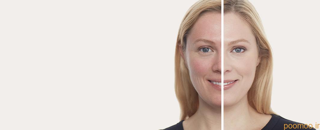 سرم ویتامین c با کاهش قرمزی پوست رنگ پوست را یکنواخت میکند.