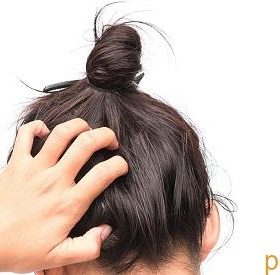 علت خارش پوست سر چیست و چه ارتباطی با ریزش مو دارد؟