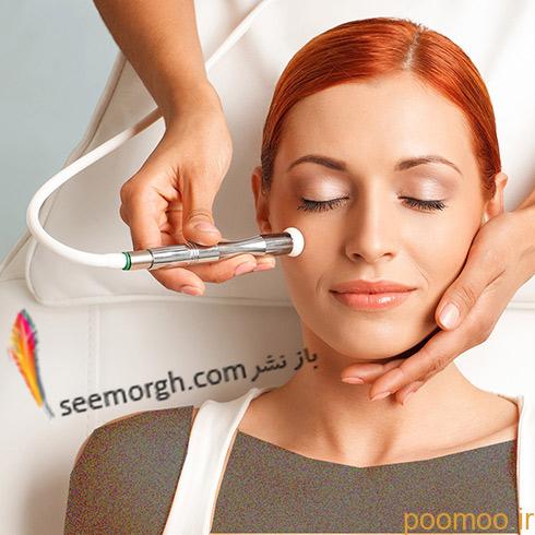 microdermabrasion,میکرودرم ابریژن