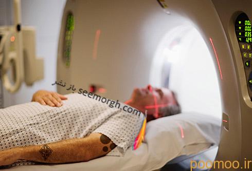 MRI گرفتن