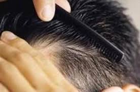 ریزش مو ی سر چه تعداد در طول روز طبیعی است؟