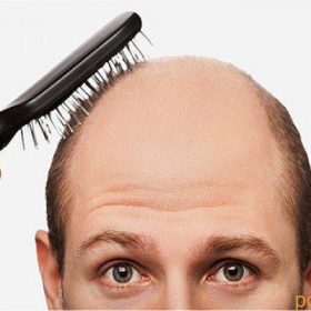 رشد مو چگونه انجام می شود؟ چه عواملی باعث ریزش مو می شوند؟