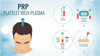 تقویت مو با prp