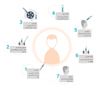 تقویت مو با روش سلول های بنیادی