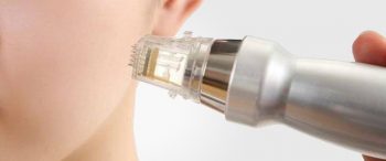 رادیوفرکانسی چیست؟