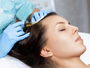 مزوتراپی موها