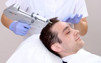 ترکیبات مزوتراپی مو