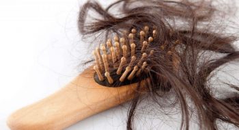 علائم ریزش موی هورمونی