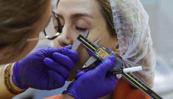 اقدامات قبل از تزریق ژل به پلک