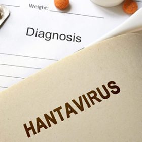 هانتا ویروس چیست؟ علایم و درمان هانتا ویروس
