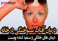آفتاب سوختگی